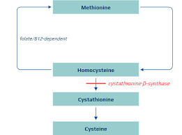 Image result for Homocystinuria