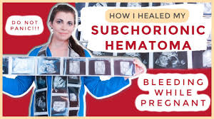 You'll be able to mark your mistakes quite easily. How Do You Pronounce Subchorionic In English Use Youtube To Improve Your English Pronunciation Ythi