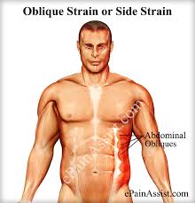 External oblique, internal oblique, and transverse abdominis, supplemented in front on each side of the midline by rectus abdominis. Oblique Strain Or Side Strain Causes Symptoms Treatment Recovery Period