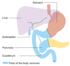 Image result for Succussion Splash