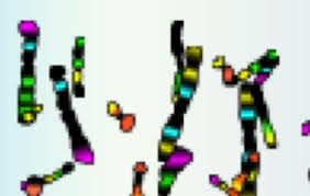 Maybe you would like to learn more about one of these? Human Karyotyping As You Progress Through The Chromosomes What Three Features Change How Many Pairs Of Chromosomes Are Shown Pdf Free Download