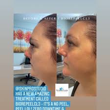 TOP 10 BEST Microdermabrasion Facial in Charleston, SC