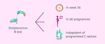Image result for Group B Streptococcus Prophylaxis