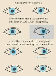 Image result for Cover Test