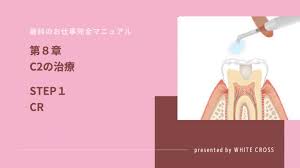 ○会話の勉強をすればするほど、 自分は全然うまくできないと不安になったことがある。 その結果、実は密かに 「このままノウハウコレクターで終わりやしないか」と 不安を感じたことがある。 æ­¯ç§'ã®ãŠä»•äº‹å®Œå…¨ãƒžãƒ‹ãƒ¥ã‚¢ãƒ« ç¬¬ï¼˜ç«  C2ã®æ²»ç™‚ Stepï¼' Cr æ­¯ç§'ã‚¹ã‚¿ãƒƒãƒ•å'ã'ãƒ¡ãƒ‡ã‚£ã‚¢dstyle ãƒ‡ã‚£ãƒ¼ã‚¹ã‚¿ã‚¤ãƒ«