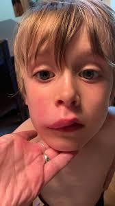 Bee removal service for large tree nest