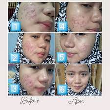 Maybe you would like to learn more about one of these? Falabelle Tamanu Oil Review Female Daily