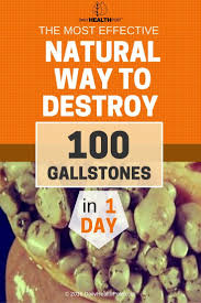 The Most Effective Natural Way To Destroy 100 Gallstones In 1 Day Via Dailyhealthpost Gallbladder Diet Gallstone Diet Gallbladder Cleanse