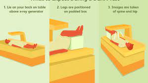 Dexa Scan Uses Procedure Results