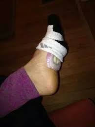 He Put Onions Into His Socks At Night For One Fascinating Reason Foot Remedies Health Tips Health And Beauty Tips