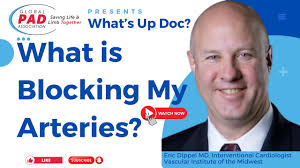 What's Blocking Your Arteries