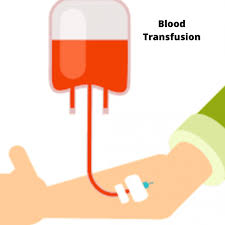 Image result for Platelet Transfusion