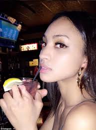 Chicago model with one foot shows off disabilities online