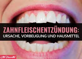 15 Hausmittel Gegen Zahnfleischentzundung Die Sofort Helfen