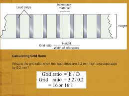 Radiographic Grids Ii By Professor Stelmark Ppt Video Online Download