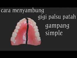 We did not find results for: Cara Menyambung Gigi Palsu Patah Sangat Mudah Banget Youtube