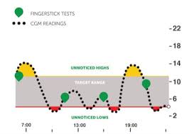 Continuous Glucose Monitors Cgms Jdrf The Type 1