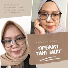 Sebetulnya ada cara mudah untuk menghilangkan tahi lalat, yaitu dengan menggunakan bawang putih loh. Pengalaman Operasi Tahi Lalat Di Rsup Dr Sardjito Marlina