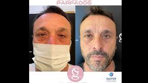 14 cirujanos plásticos de Blefaroplastia en Salta (ciudad)