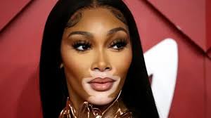 Amavuta ahindura uruhu muri Nigeria: 'Nasigiye inkovu abana banje 6'