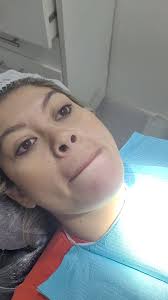 Recuerda siempre ponerle una Sonrisa a la vida.. 👨🏻‍⚕️👩🏻‍⚕️ Dra. Irene  Ledezma Paz Dr. Ronald Antelo Ricaldi 📍Manfredo Cuellar esquina Alcides  Paz #591 📲 76090374-76087861 Aprovecha las Promociones del mes de Noviembre