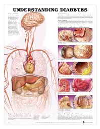 Understanding Diabetes Anatomical Chart