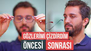 lazer goz ameliyati oldum oncesi sonrasi ve tum yasadiklarim youtube