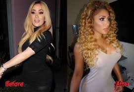 Nikki Mudarris Before And After Surgery Transformation Miss Nikki Baby Nikki Baby Nikki Mudarris