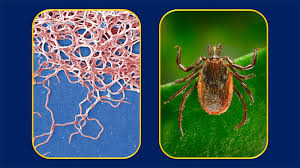 In 1982, a few years after lyme disease was first diagnosed, it was determined that b. Research Story Tip Lyme Disease Bacteria Alter Immune System And May Cause It To Attack Healthy Cells