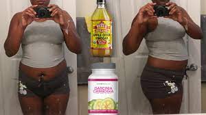 Apple cider vinegar, also sometimes referred to as acv, is a vinegar made from fermented apple cider.making apple cider vinegar starts with adding yeast to apple juice, transforming the juice into. Garcinia Cambogia And Apple Cider Vinegar Diet Day 1 Youtube