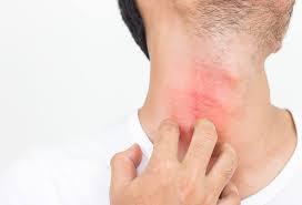 Instead, the tip of an ingrown hair ingrown hairs commonly occur on the face, neck, armpits, pubic region, and legs. Get Rid Of Razor Bumps On Your Neck Archives Tend Skin Solution Ingrown Hair Razor Bumps Blog
