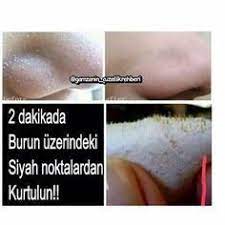 Bulamayanlar Icin Bir Kez Daha Veriyorum Merhabalar Arkadaslar Bugun Burun Uzerindeki Siyah Noktalardan Kurtulmak Icin Tarif Vereceg Siyah Noktalar Jelatin Ve Siyah Lekeler