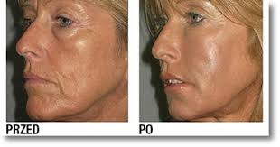 Fitness dla twarzy Piła