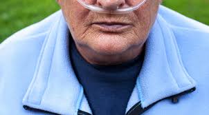 Image result for Emphysema