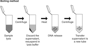 Dna Extraction Finding The Most Suitable Method Sciencedirect