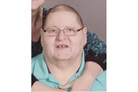 Allan Dupont Obituary (1954