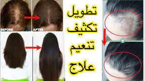 وصفة الفنانة شريهان لتطويل الشعر وتكثيفه وتنعيمه علاج تساقط وتقصف الشعر علاج الثعلبة youtube hair growth faster long hair styles hair growth