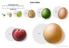 As there are 2.54cm in an inch, to convert your cm figure to inches you need to divide your figure by 2.54. Tumor Size Centimeters Image Details Nci Visuals Online