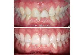 How To Become A Cosmetic Dentist | Avant Dental