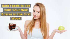 — have lots of soft food on hand. What Are The Best Foods To Eat With Your New Braces In The First Week Urbandale Smiles