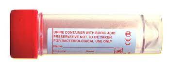 Testing center at morehead state university, morehead, ky. Mid Stream Urine Msu Microscopy Culture Uti Cystitis