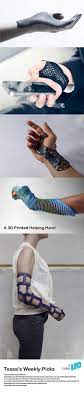 A 3d Printed Helping Hand 5 Designs Of 3d Printed Hand Braces Tessa S Weekly Picks Make It Leo 3dprintingideas 3d Printing 3d Printing Fashion Prints