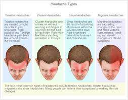 Different Types Of Headaches Chart Sada Margarethaydon Com