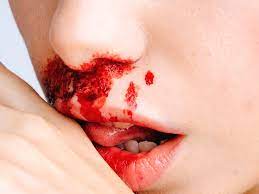 But the need for blood donations has never been greater. Drinking Blood A Disorder Or Safe Treatment For Some Conditions
