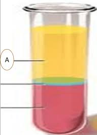 Check spelling or type a new query. Ukom Hematologi Professional Development Quiz Quizizz