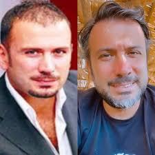 Ertem Sener Saclarimin Degisimi Konusunda Cok Soru Aliyorum Tek Yaptigim Sac Ekimiistanbul Hairlineairline I Tercih Etmek Oldu Siz De Saca Ve Sakal Ekimi Icin Hemen Whatsapp Hattindan 90 538 3385454 U Arayin