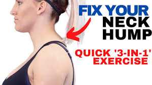 I see this especially with people who have forward head posture. Neck Hump Fix Chiropractic On Eagle Dr Jon Saunders