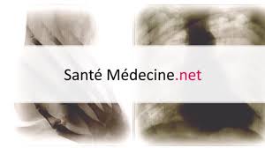 Quels Aliments Eviter En Cas De Constipation