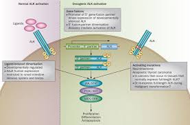 Sometimes fluid in the lungs can make breathing difficult and this could also be a sign of lung cancer. Treating Alk Positive Lung Cancer Early Successes And Future Challenges Nature Reviews Clinical Oncology