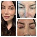 James B. Depew, MD, FACS, Board Certified Plastic Surgeon